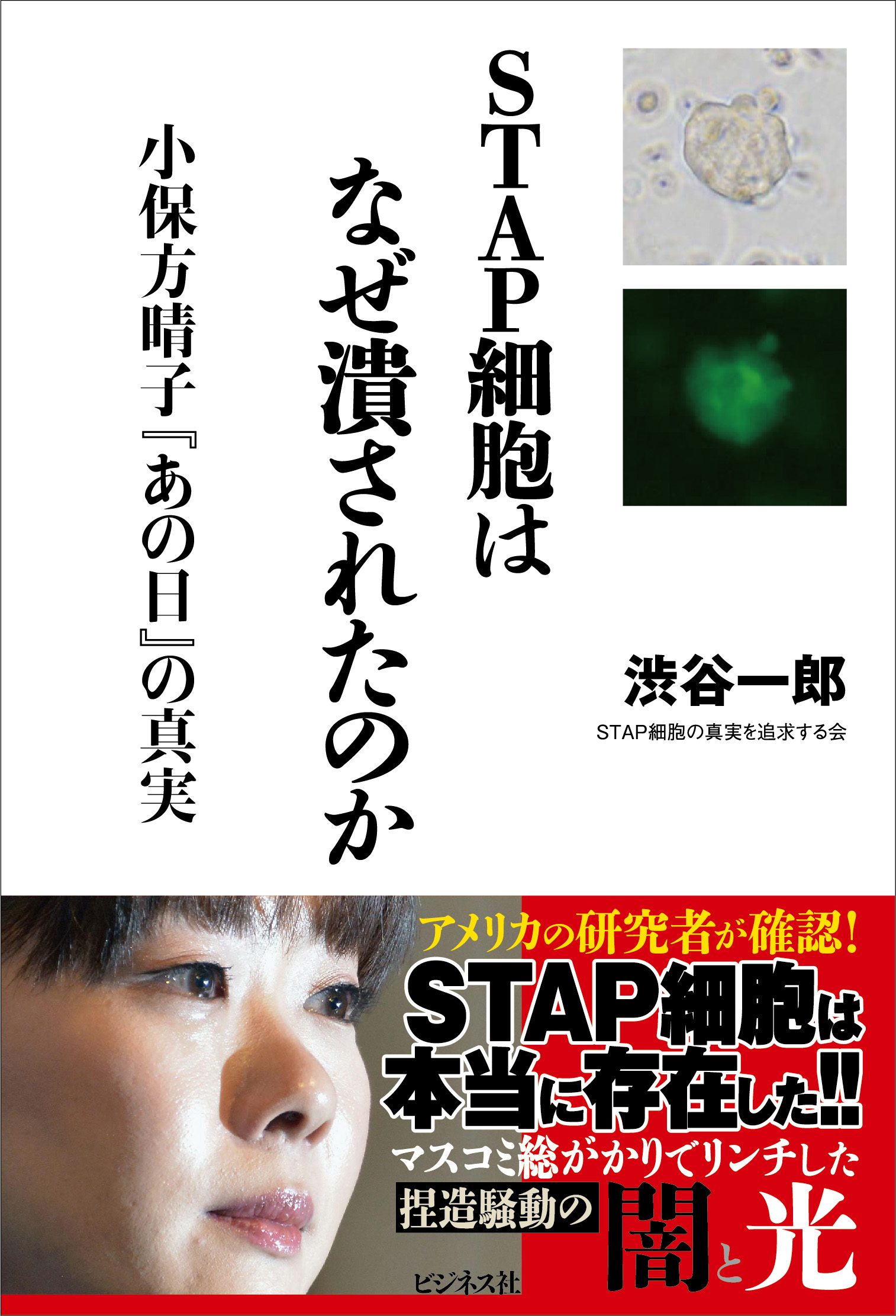 STAP細胞はなぜ潰されたのか